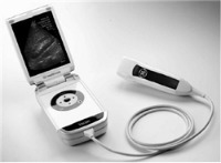 V-Scan ultrasound